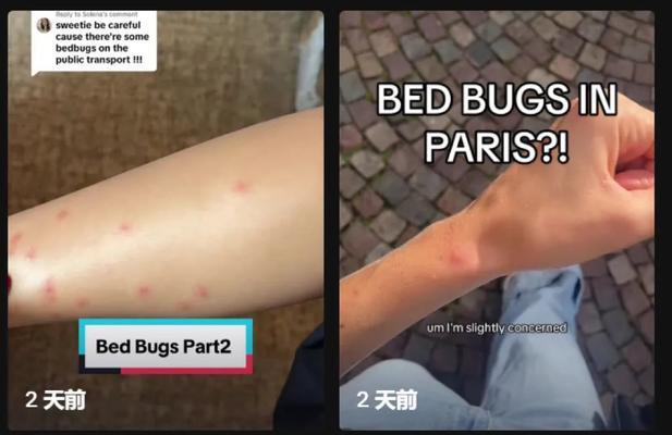 了解臭虫咬的包是怎样的（臭虫咬包症状及预防方法解析）
