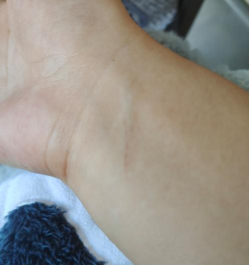 猫打疫苗（重要性、时间表与常见部位选择）