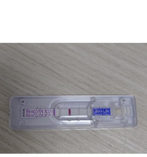 幼犬的狗瘟疫苗接种方法与注意事项（保护幼犬免受狗瘟侵害的关键措施）