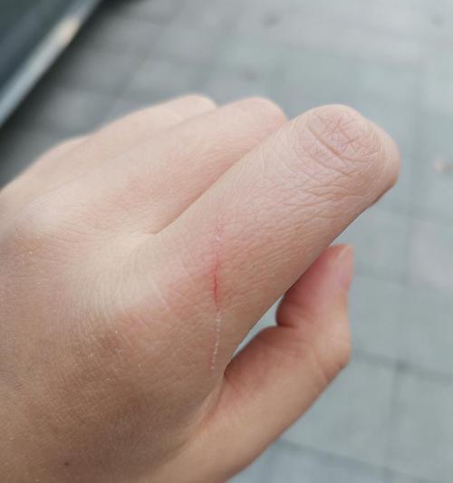猫疫苗失效的原因及预防措施（探究猫疫苗失效的可能性和提供有效的预防方法）