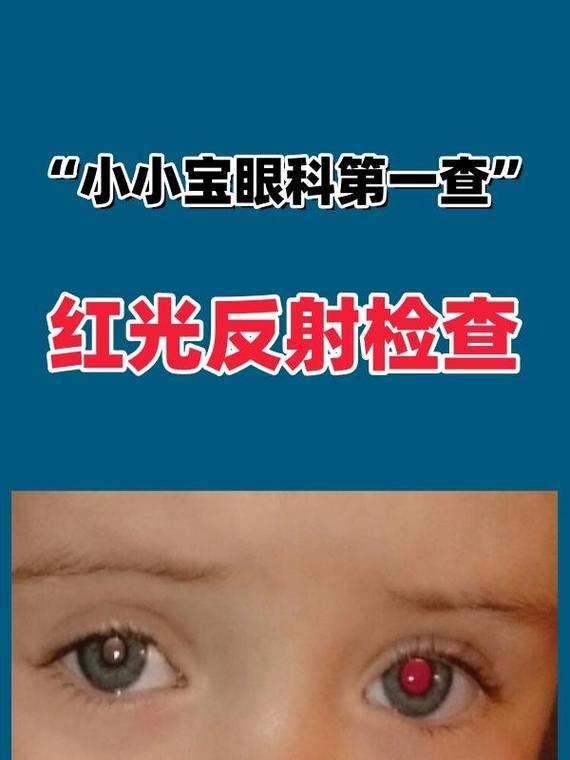 解读瞳孔的颜色（探索瞳孔颜色的影响因素及健康意义）