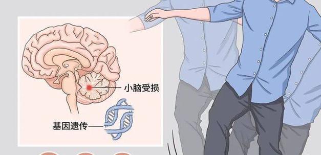 狗狗共济失调症（了解狗狗共济失调的症状和如何进行治疗）