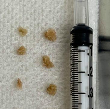 肾结石猫的寿命及保健（探索肾结石猫的生命周期以及如何延长寿命）