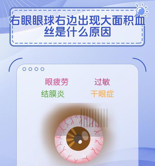 以眼睛撞伤充血，多久能退？（深入探讨眼睛撞伤后充血的持续时间及处理方法）